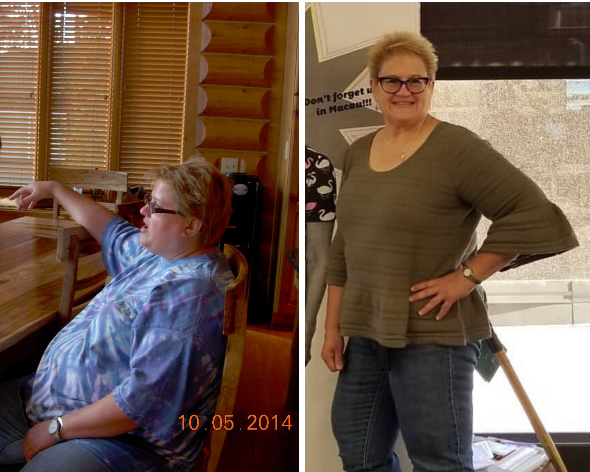 Before and After Bariatric Surgery - seated vs. Happy and slim